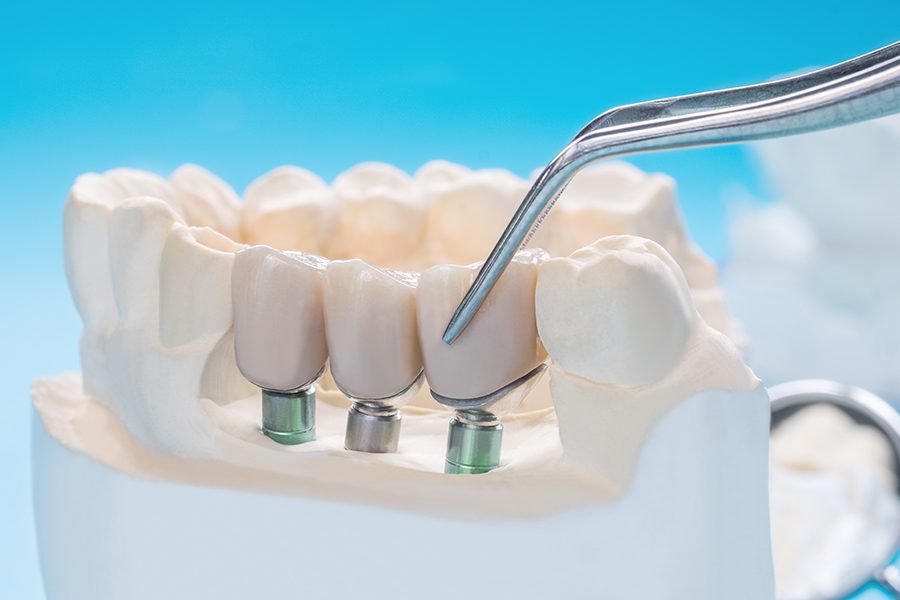 Protetică dentară Renew Dental Office Jebel Stomatologie Timișoara